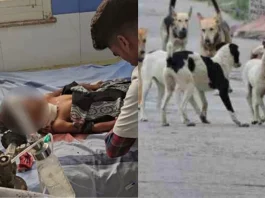 Madhya Pradesh On Friday, a five-year-old child died in the Khargone area of Madhya Pradesh after being attacked by stray dogs.
