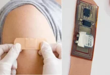 Wireless smart bandage can cure chronic wounds and improve skin recovery reveals Study