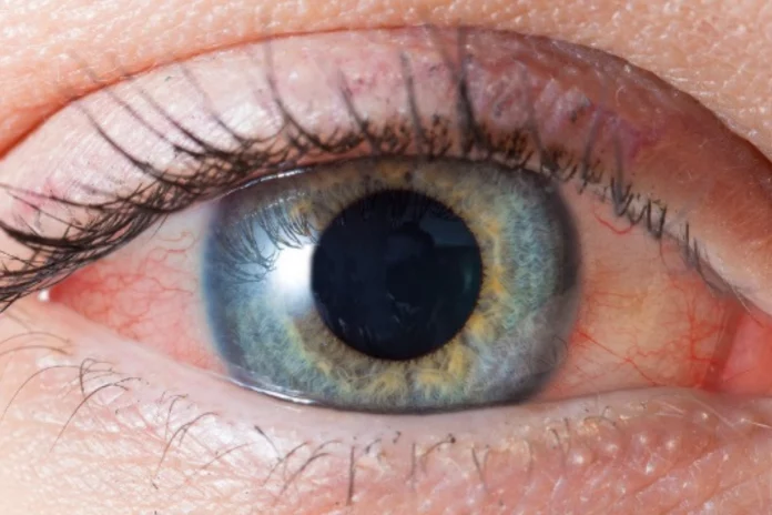 Pollution Eye Care Tips Pollution Eye Care Tips: Protect your Eyes in Pollution with these Easy Tips