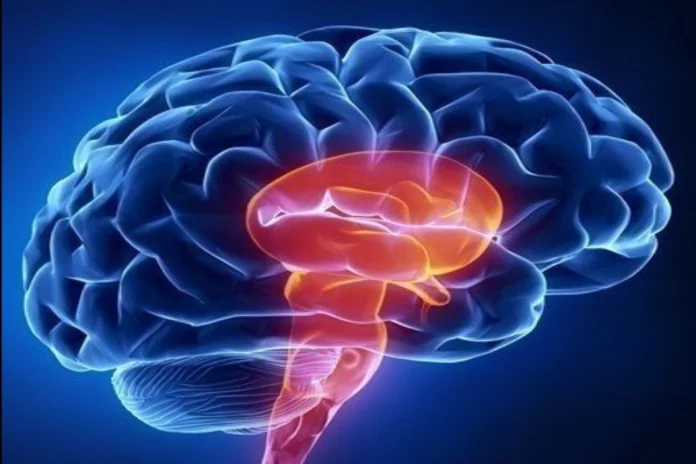 Brain Stroke Brain Stroke