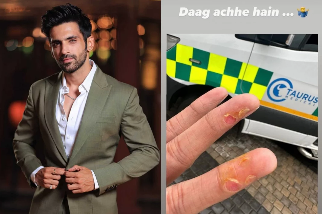 Arjit Taneja suffers a minor injury