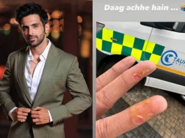 Arjit Taneja suffers a minor injury