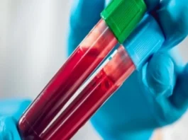 Cancer detection