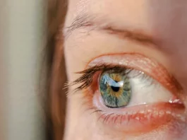 Dry Eyes