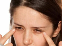 Dark Circles