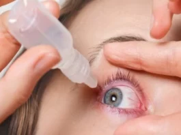 conjunctivitis