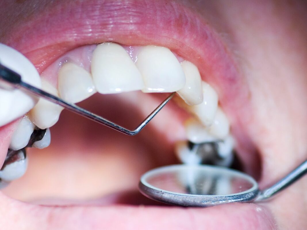 Cavity