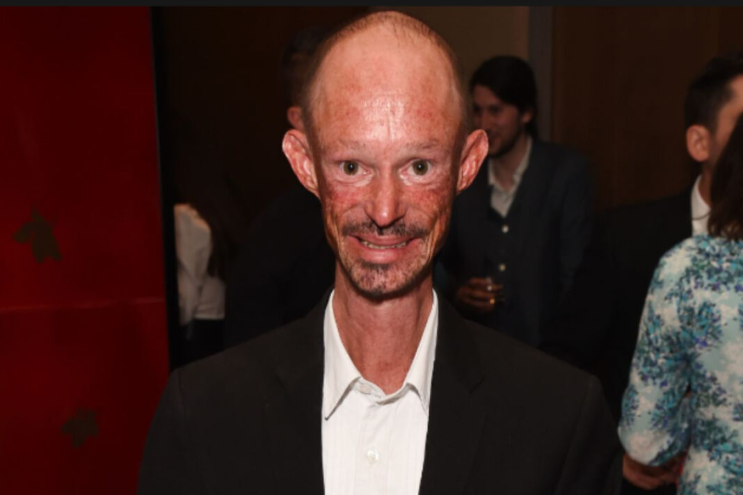 Darren Kent