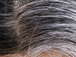Grey Hair
