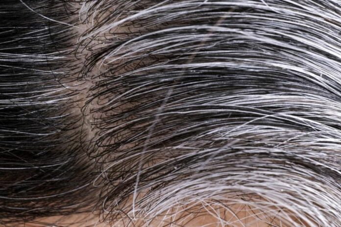 Grey Hair