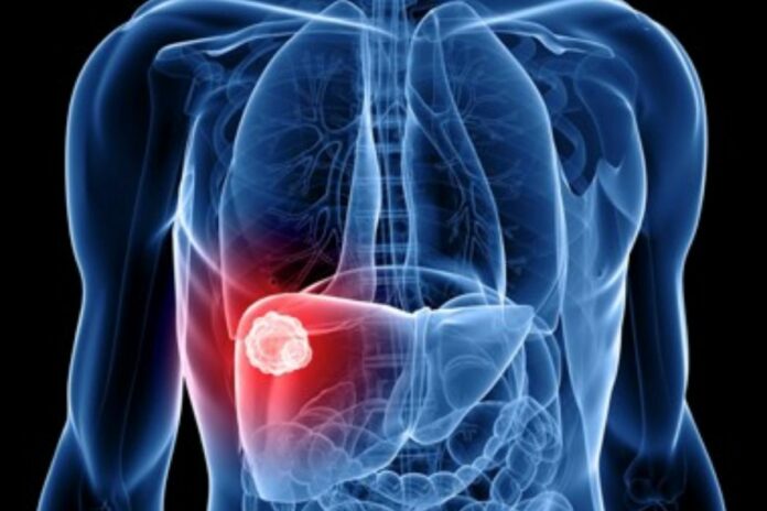 Sugary Drinks Sugary Drinks