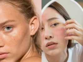 Skincare Tips