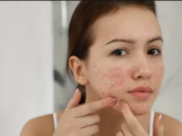 Skincare Tips