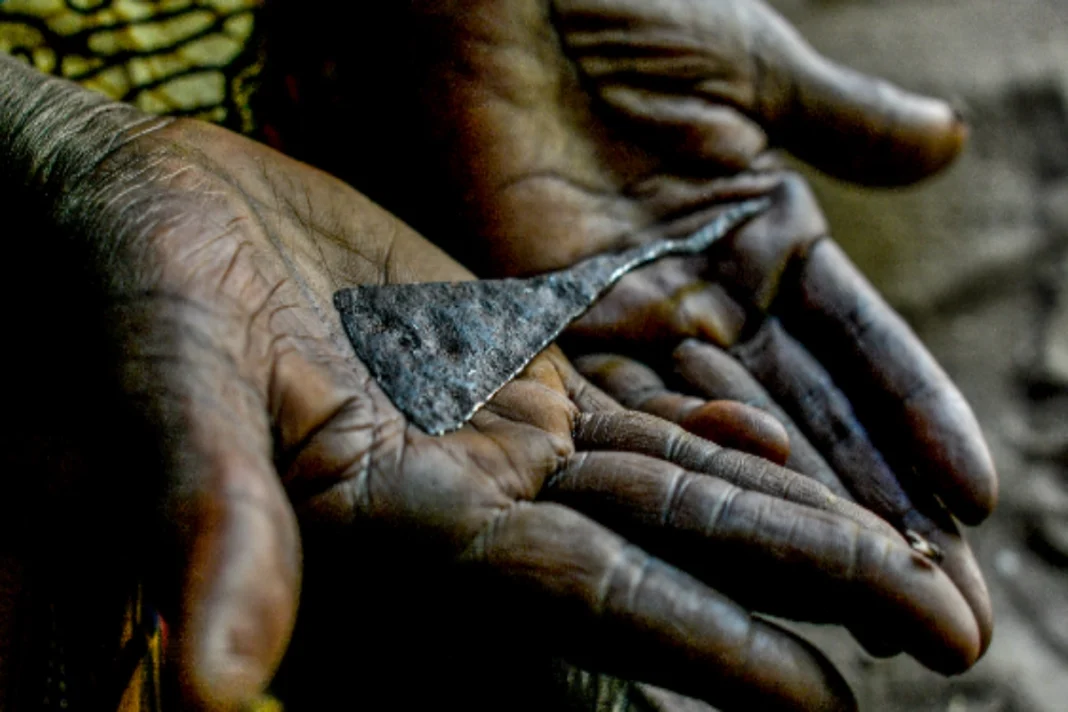 Female Genital Mutilation