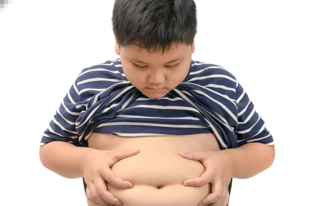 Child Obesity