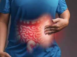 Inflammatory Bowel Disease