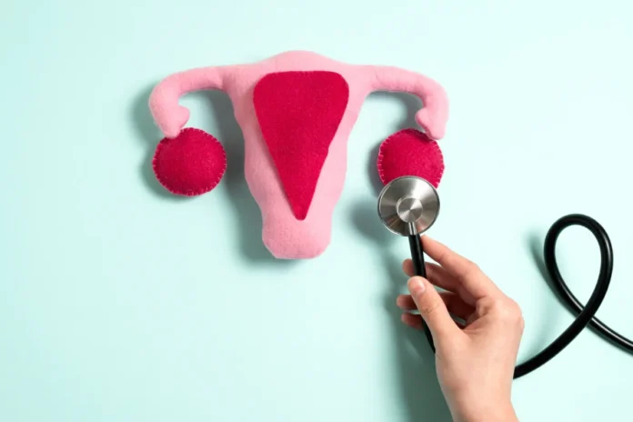 Ovarian Cancer Ovarian Cancer