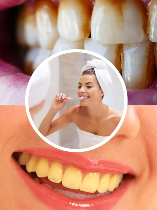 Tobacco Teeth (1)