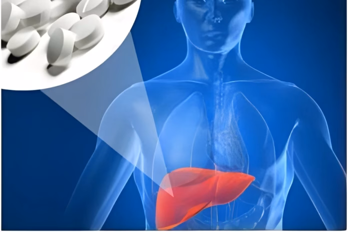 Fatty Liver