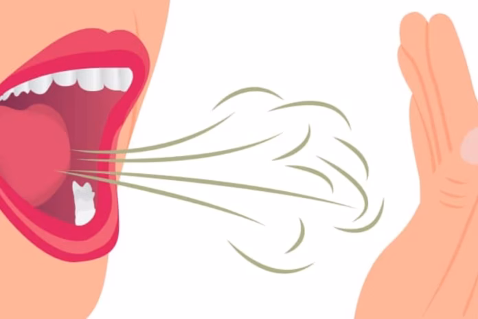 Bad Breath Bad Breath
