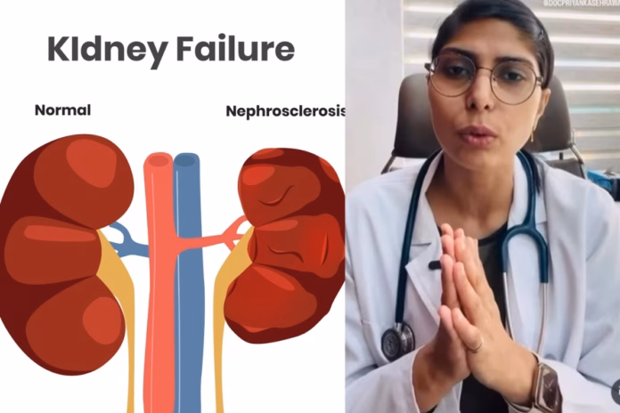 Can Kidney Failure Happen Silently AIIMS Doctor Warns THESE Patients