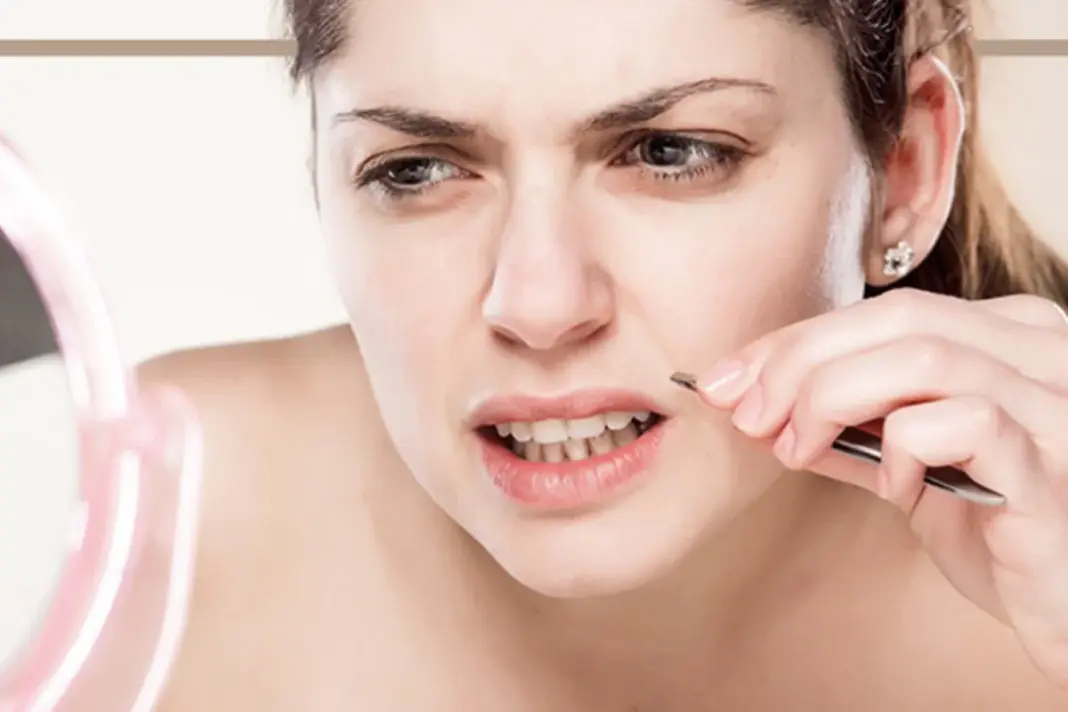 Excess Facial Hair Solutions