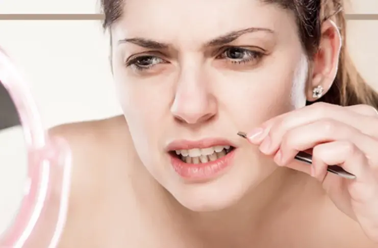 Excess Facial Hair Solutions