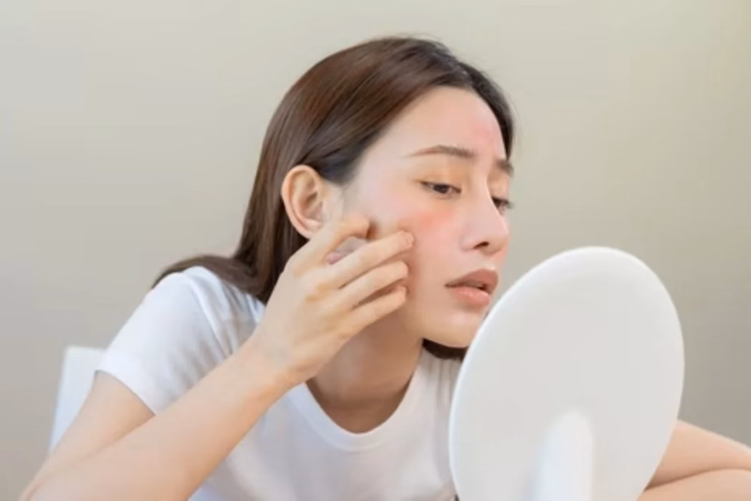 Facial Signs of Health Problems