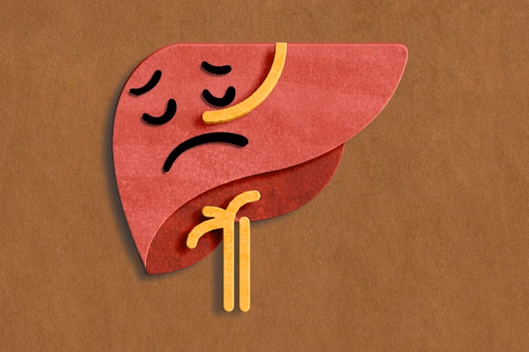 Liver Health