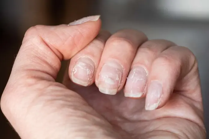 Nail Care Tips