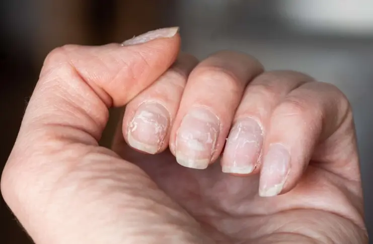 Nail Care Tips