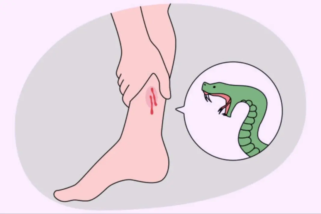 Snake Bite - What To Do