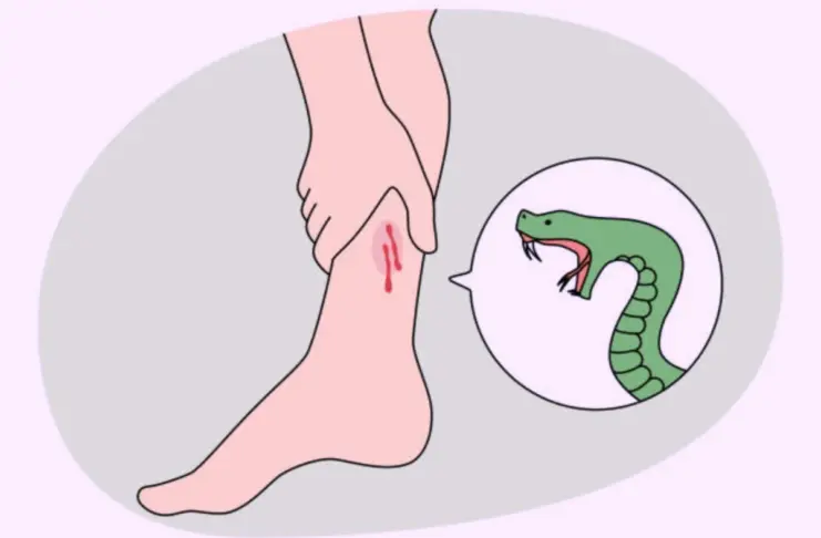 Snake Bite - What To Do