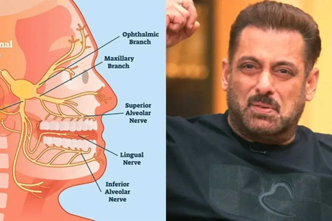 Trigeminal Neuralgia