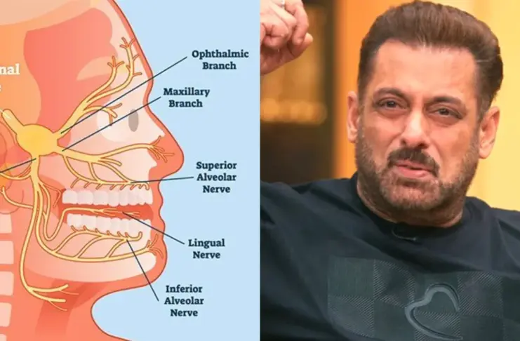 Trigeminal Neuralgia