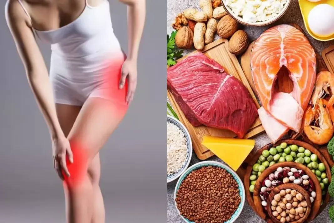 Uric Acid Management