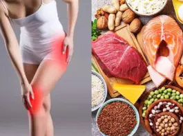Uric Acid Management