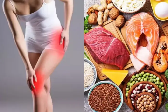 Uric Acid Management
