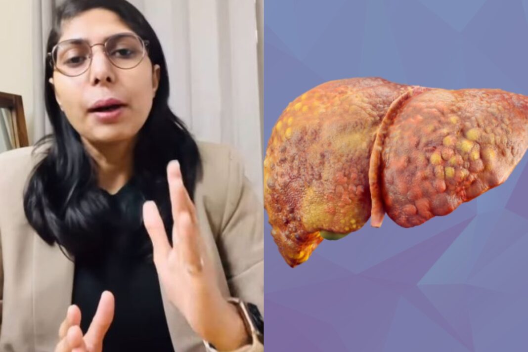 Fatty Liver Warning Signs, Risk Factors And Diet Tips