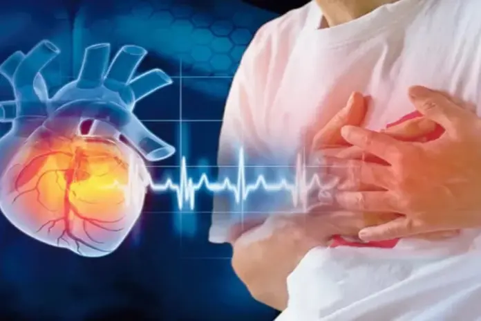 Cardiac Deaths heart attack