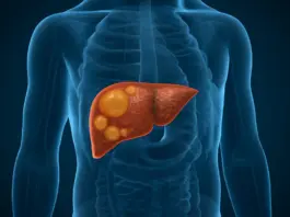 Dangers Of Fatty Liver