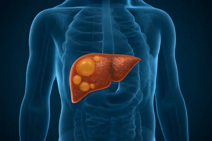Dangers Of Fatty Liver