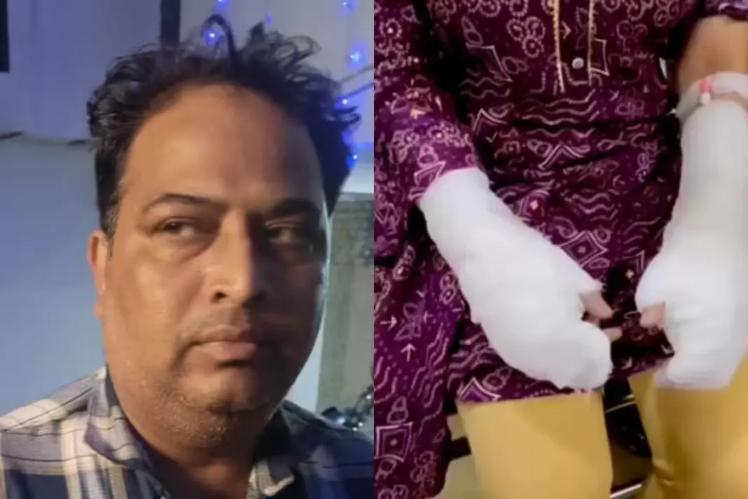Delhi-Acid-Attack Delhi-Acid-Attack