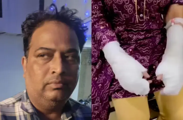Delhi-Acid-Attack