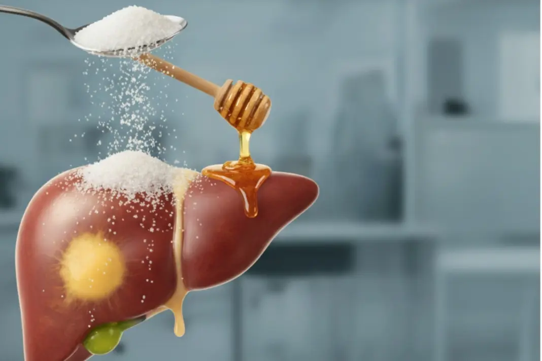 Fatty Liver Sugar And Honey Impact