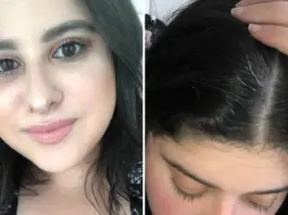 Grey Hair