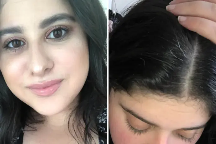 Grey Hair