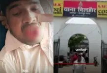 Kanpur Viral Video: Casanova Gets a Taste of His Own Medicine! Girl Bites Off Piece of Man’s Tongue During Alleged Forcible Kiss in Field Kanpur Viral Video
