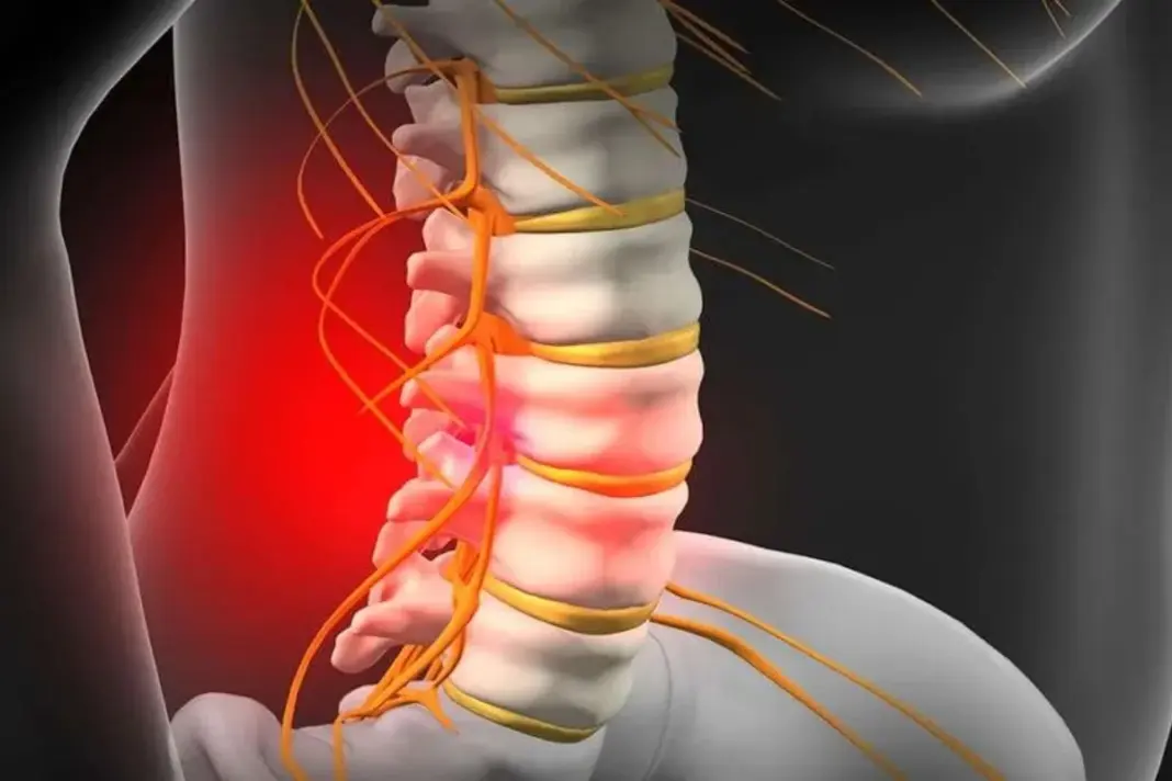 Slip Disc Patients Alert