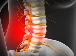 Slip Disc Patients Alert
